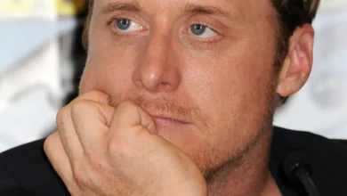 alan tudyk left eye